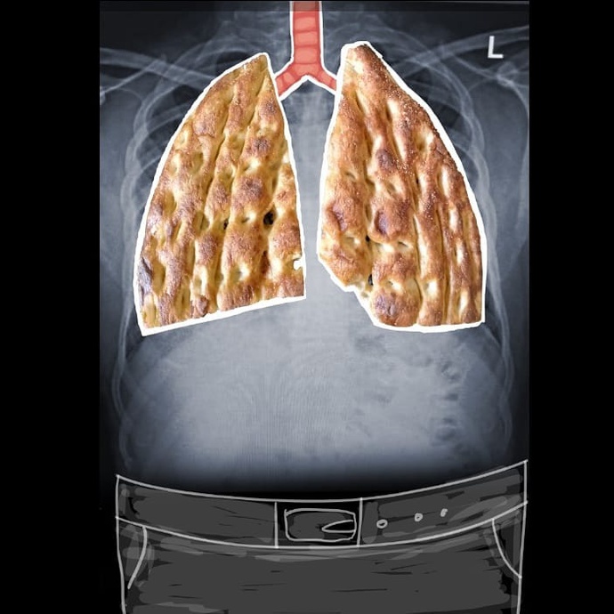 By: لاله ضیایی/ایران