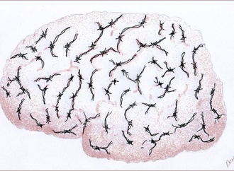 
                                                            bernard bouton france 36